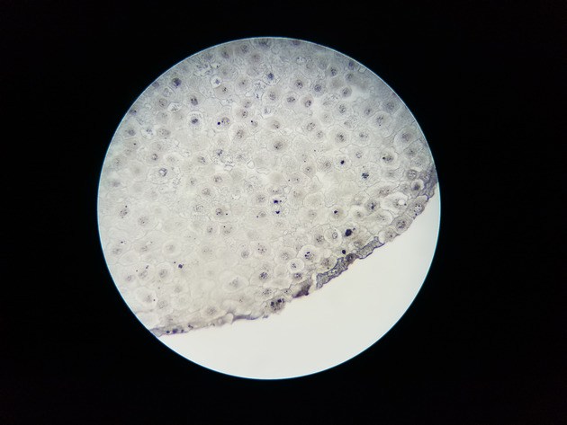 White Fish Mitosis Slides - White Fish Mitosis 03 100X